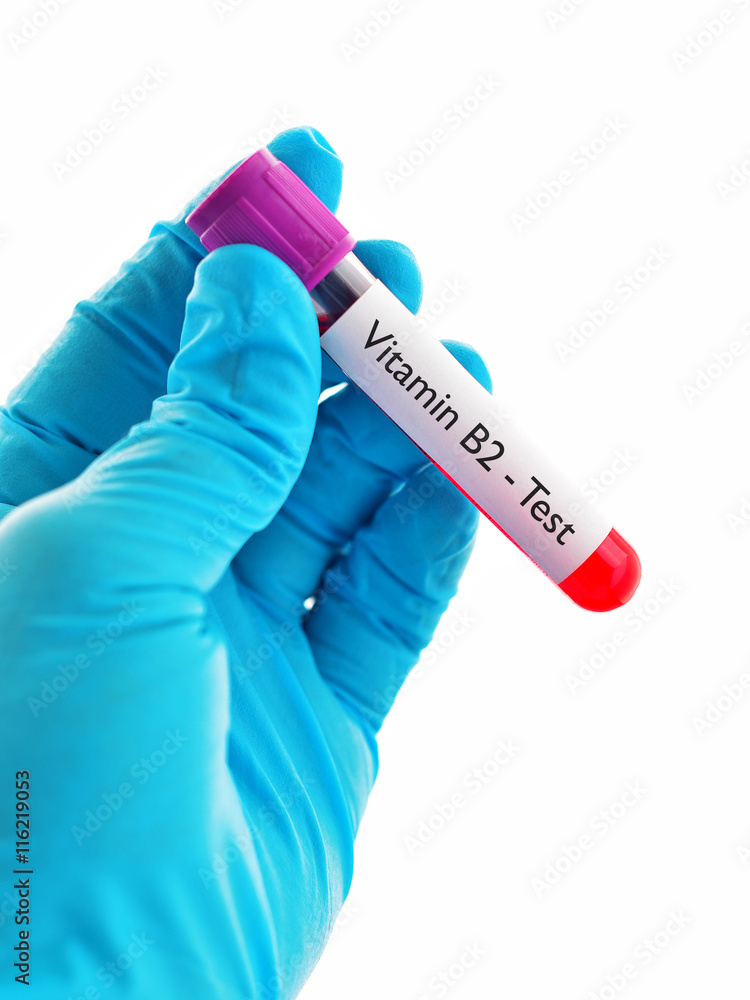 Fototapeta premium Test tube with blood sample for vitamin B2 test