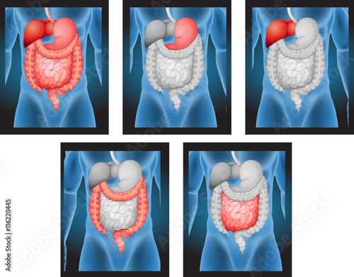 X-ray films of human organs