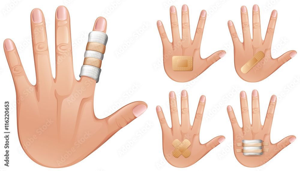 Obraz premium Fingers and hands wrapped with bandages