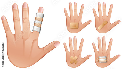Fingers and hands wrapped with bandages