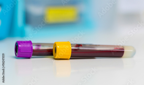 Blood sample