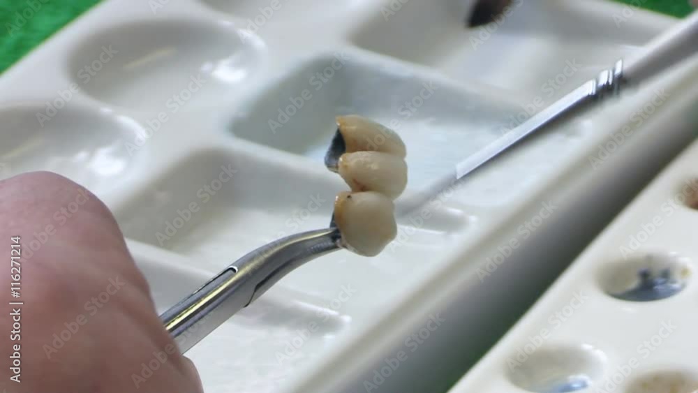 Dentist working with ceramic material, brush and dentures. Workplace dental technician. Close up Dentist working with ceramic material, brush and dentures. Workplace dental technician. Close up