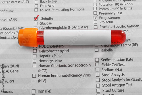 Blood sample on medical report