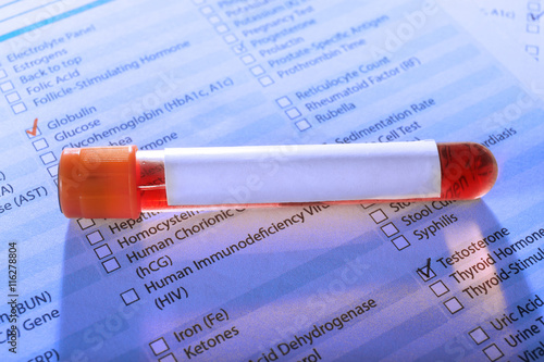 Blood sample on medical report