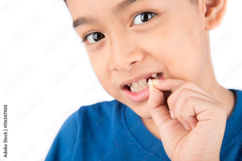 Little boy showing baby teeth toothless close up waiting for new teeth Little boy showing baby teeth toothless close up waiting for new teeth