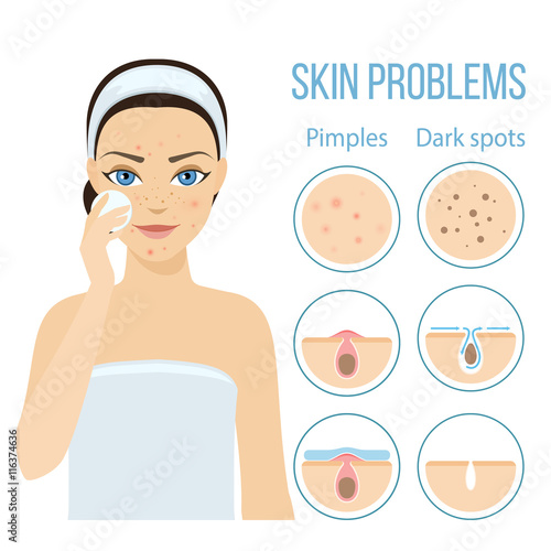 Girl cleans her face with cosmetic lotion. Skin problems solution, home remedies. Vector stock illustration.