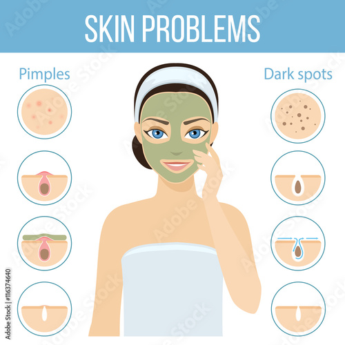 Girl applies cosmetic mask on her face. Skin problems solution, home remedies. Vector stock illustration.