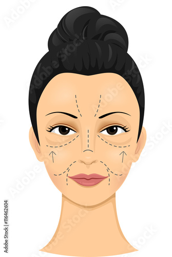 Girl Face Incision Lines