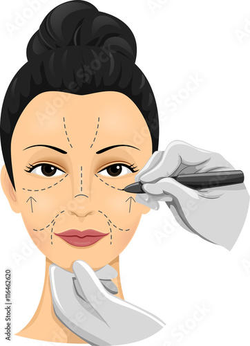Girl Incision Lines Marker