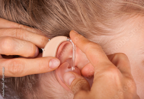 Obraz na płótnie Hearing aid inserting close up
