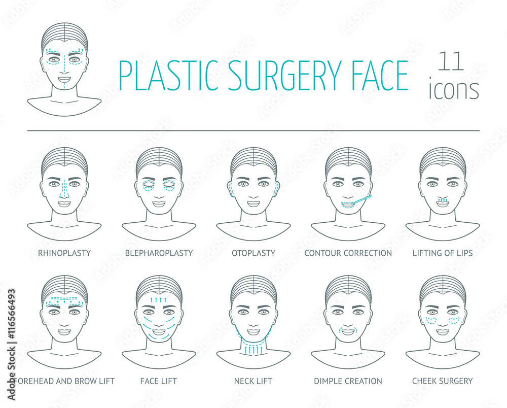 11 line plastic surgery face icons. Flat design. Vector 11 line plastic surgery face icons. Flat design. Vector