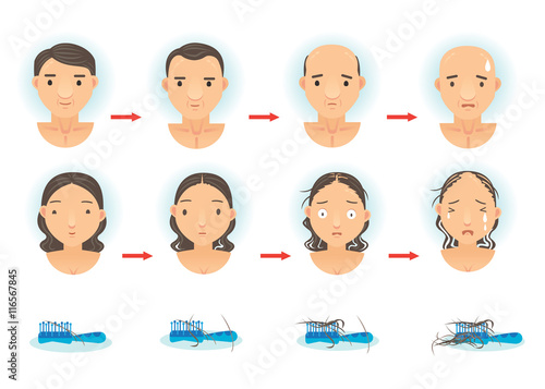 Hair Loss/The process of hair loss. Cartoon vector illustration