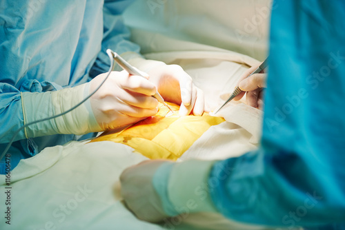hands of cardiac surgeon at surgery operation photo