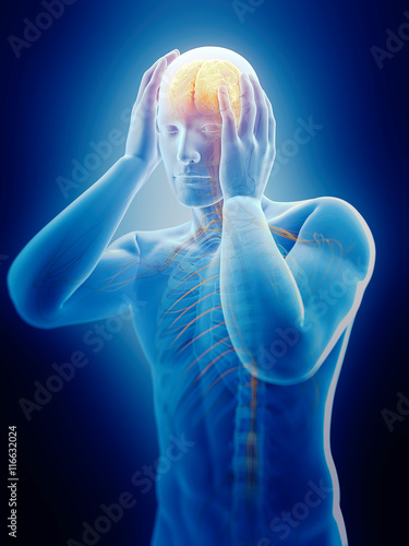 medically accurate 3d illustration of headache/ migraine