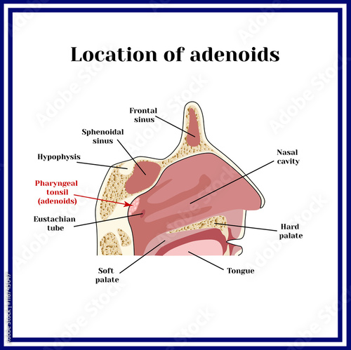 Location of adenoids.The structure of the nasopharynx.