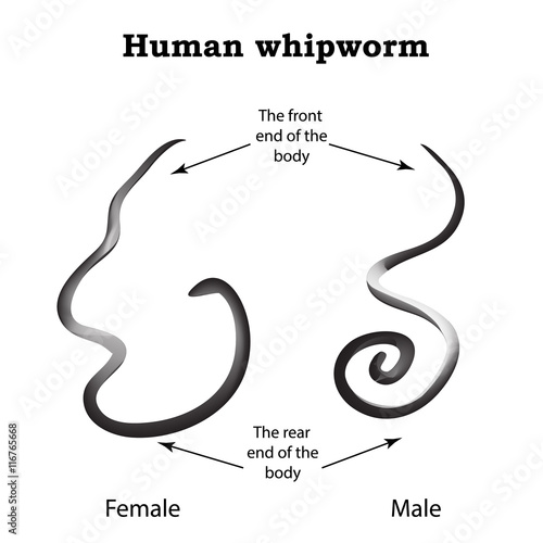 Whipworm. Structure whipworm females. The structure of the male whipworm. Infographics. Vector illustration on isolated background
