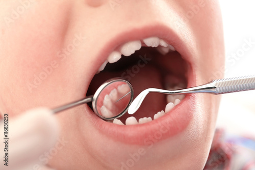 Dentist examining boy's teeth, close up