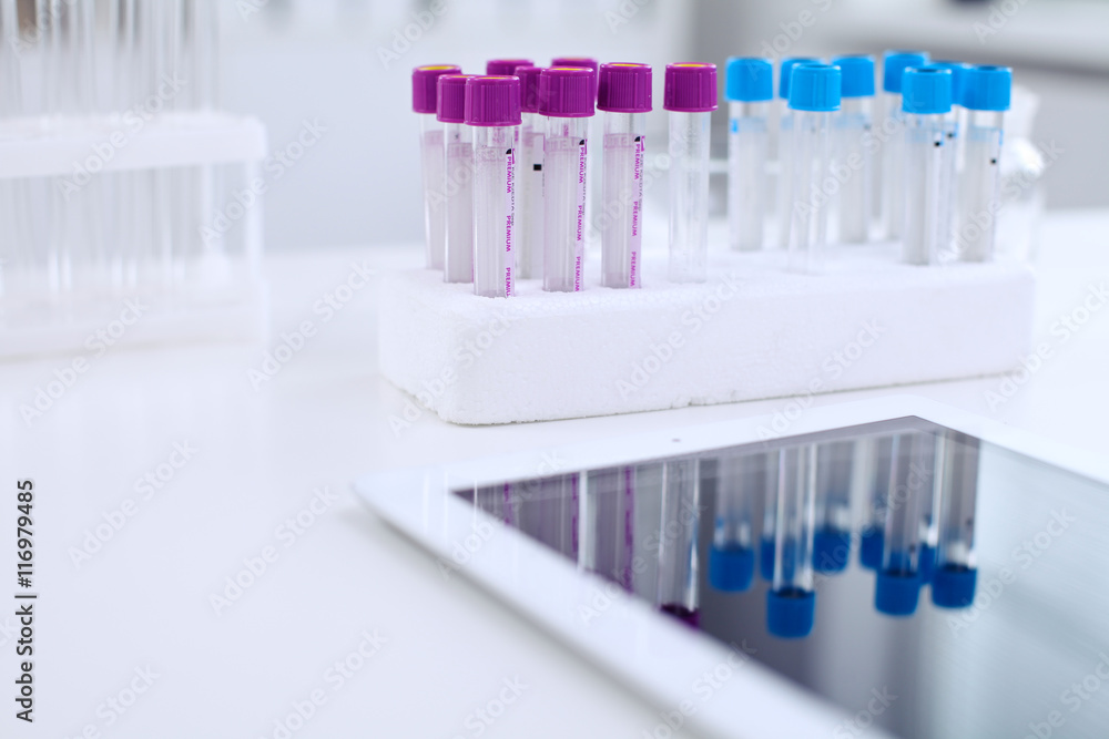 Research laboratory working space. Test tubes and tablet PC are lying at the table. Medical equipment. Blood test Research laboratory working space. Test tubes and tablet PC are lying at the table. Medical equipment. Blood test