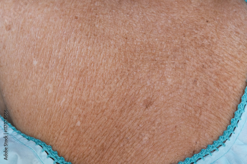  old black women wither skin