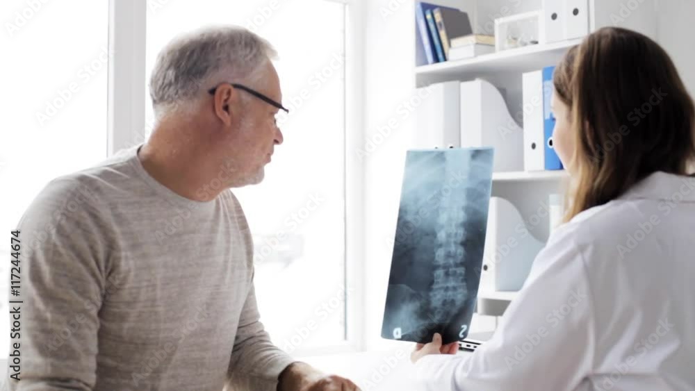 doctor with spine x-ray and senior man at hospital 72 doctor with spine x-ray and senior man at hospital 72