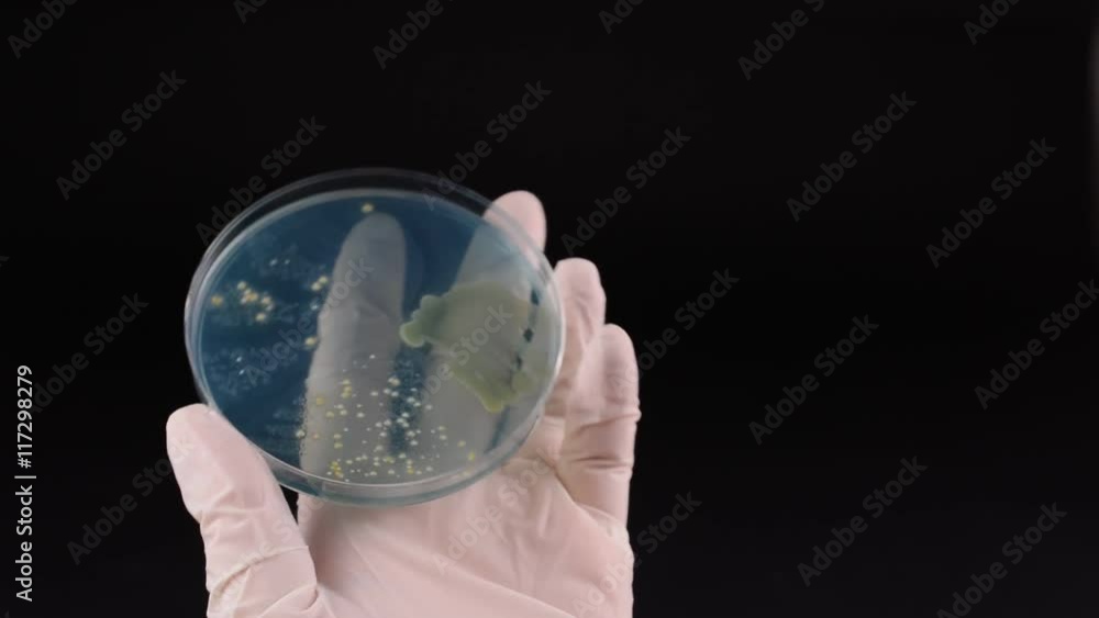 Scientist's hand checking petri dish and pointing with inoculation loop