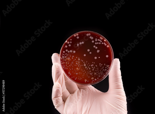 Hand holding petri dish infected with Staphylococcus Aureus bacteria on black background