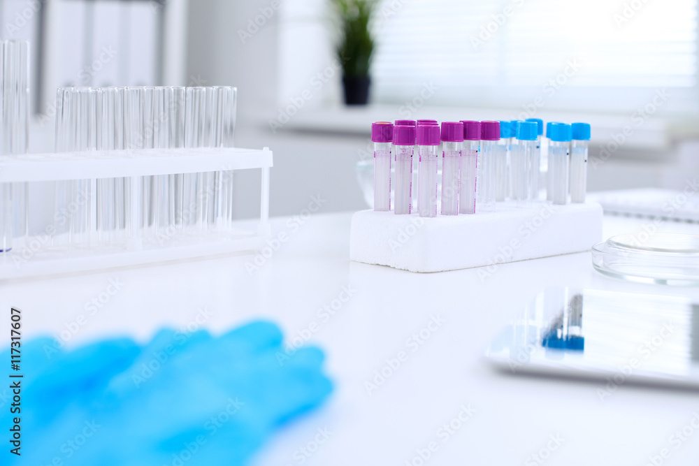 Research laboratory working space. Test tubes and tablet PC are lying at the table. Medical equipment. Blood test Research laboratory working space. Test tubes and tablet PC are lying at the table. Medical equipment. Blood test