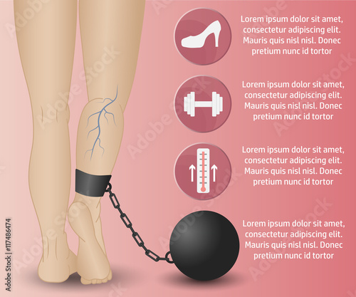 varicose Infographics phlebology