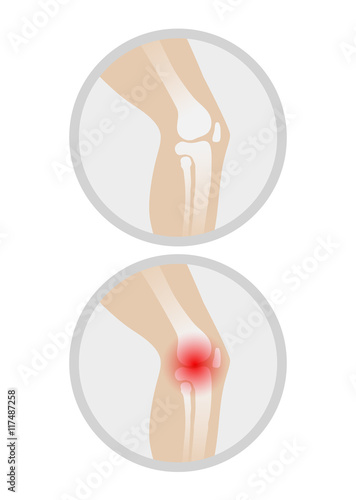 Orthopedic medical icons