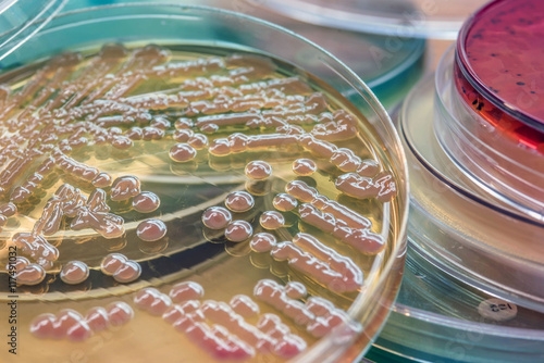 Vászonkép Bacterial colonies culture on MacConkey agar