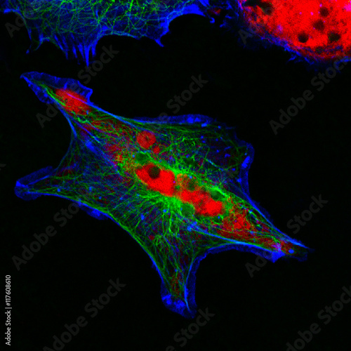 Real fluorescence microscopic view of human neuroblastoma cells
