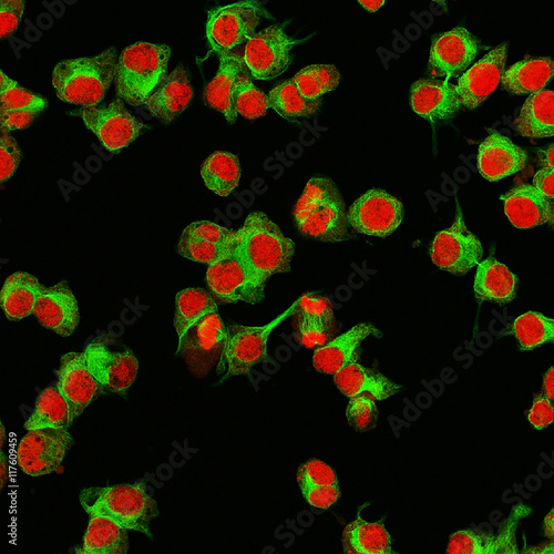 Real fluorescence microscopic view of human neuroblastoma cells