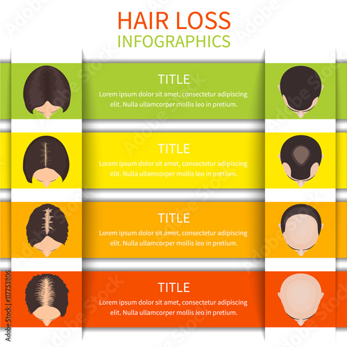 Female and male pattern hair loss set. Hair loss infographic design template. Hair care concept. Hair loss clinic concept design. Vector illustration.