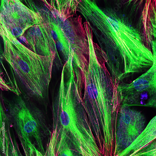 Confocal microscopy of fibroblast cells