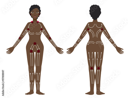 black woman's lymphatic massage diagram, Treatment of the swelling, vector illustration