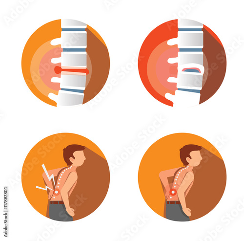 set of  flat icons with spine's problems