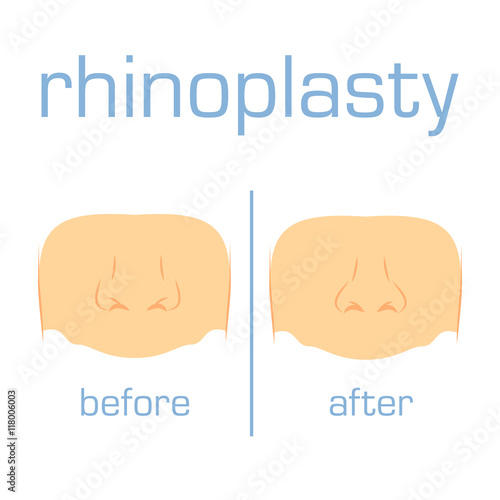 Correction form size nose white back