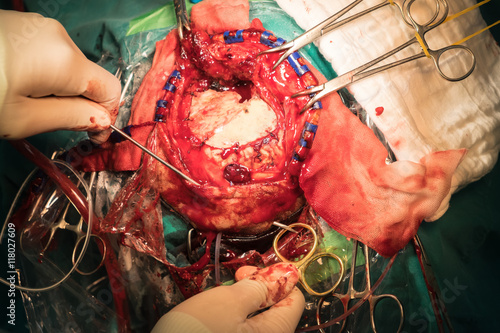 Neurology  surgical