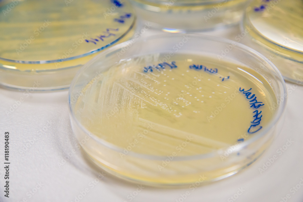 Methicillin-Resistant Staphylococcus aureus (MRSA) cross-streak culture on an agar plate. Medical microbiology concept. Methicillin-Resistant Staphylococcus aureus (MRSA) cross-streak culture on an agar plate. Medical microbiology concept.