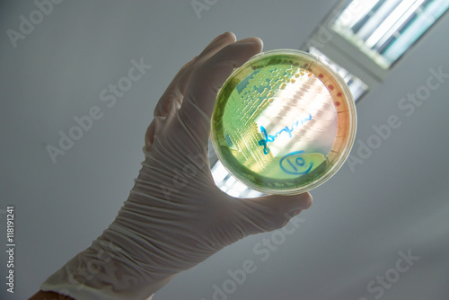 A clinical microbiologist holds up an MacConkey agar plate containing multidrug-resistant (MDR) Pseudomonas aeruginosa against the light for identification. photo