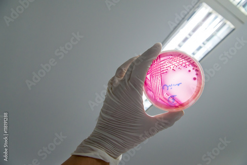 A microbiologist holds up an MacConkey agar plate containing Enterohemorrhagic Escherichia coli (EHEC), a foodborne pathogen that causes severe diarrhea, against the light for identification. photo