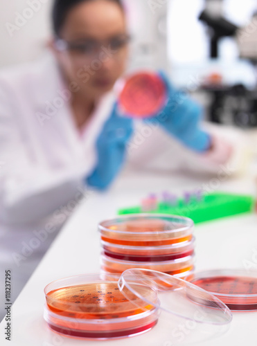 Scientist examining microbiological cultures in a petri dish photo