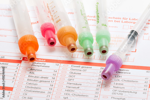 Blutuntersuchung, Blutproben auf einem Laborformular