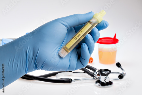 Arzt hält Urin Probe in der Hand (großes Blutbild) photo