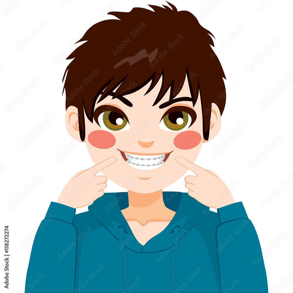 Boy smiling showing braces and pointing mouth with hands Boy smiling showing braces and pointing mouth with hands