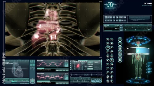 Futuristic heart scan. Holographic medical application interface. 