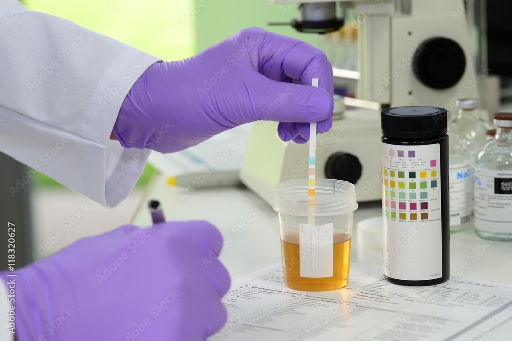Doping und Drogentest mit Urinprobe im Labor mit Urinteststreife Doping und Drogentest mit Urinprobe im Labor mit Urinteststreife