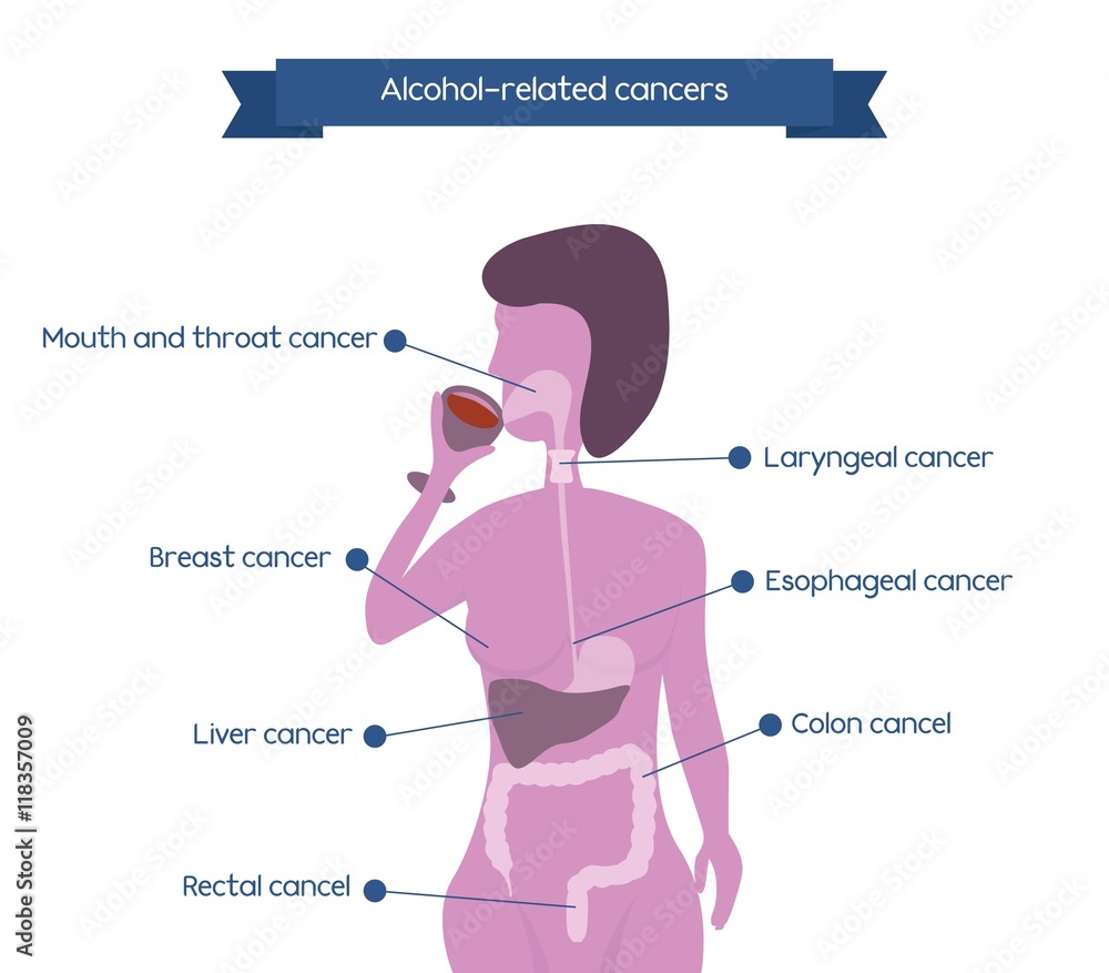 Obraz premium Alcohol related cancers infographics. Woman silhouette drinking wineglass