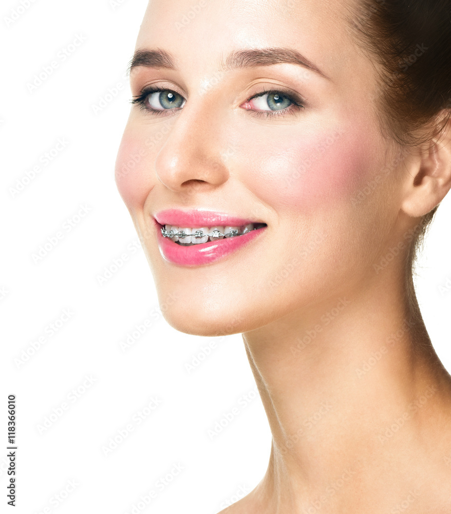 Beautiful young woman with teeth braces Broad smile girl with me Beautiful young woman with teeth braces Broad smile girl with me