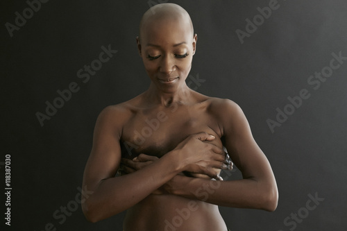 Female cancer survivor covering breasts